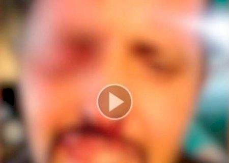 Homem cai sobre haste de retrovisor e perde olho durante briga de rua