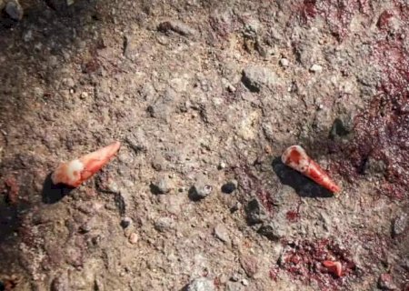 Adolescente é espancado com pedra, perde dentes e tem o rosto desfigurado
