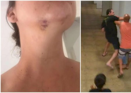 Homem agride vizinha com chute no rosto durante briga em condomínio