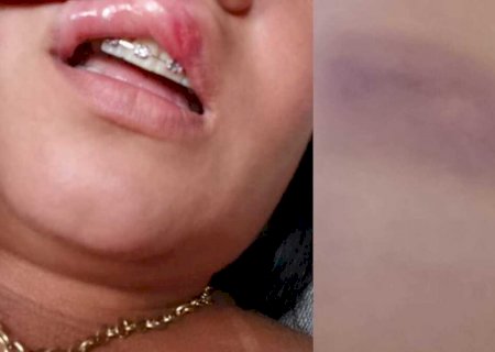 'Estou machucada por dentro e por fora': diz mulher que fugiu do namorado