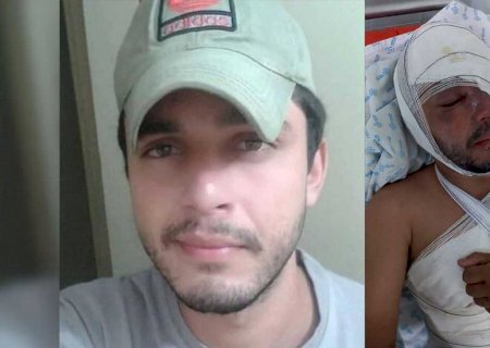 Homem atacado com água fervente recebe alta e fará tratamento para recuperar visão