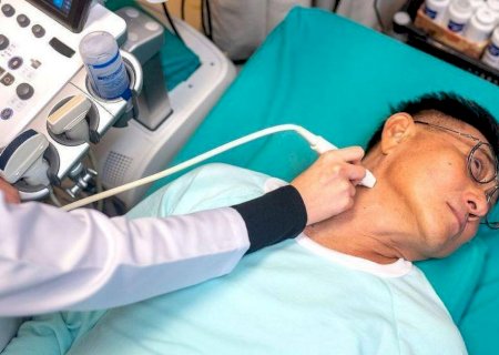 Por que os casos de câncer de tireoide estão aumentando em todo o mundo?