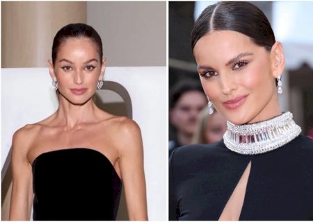 Cirurgião plástico alerta sobre alterações visuais de Izabel Goulart | VEJA Gente